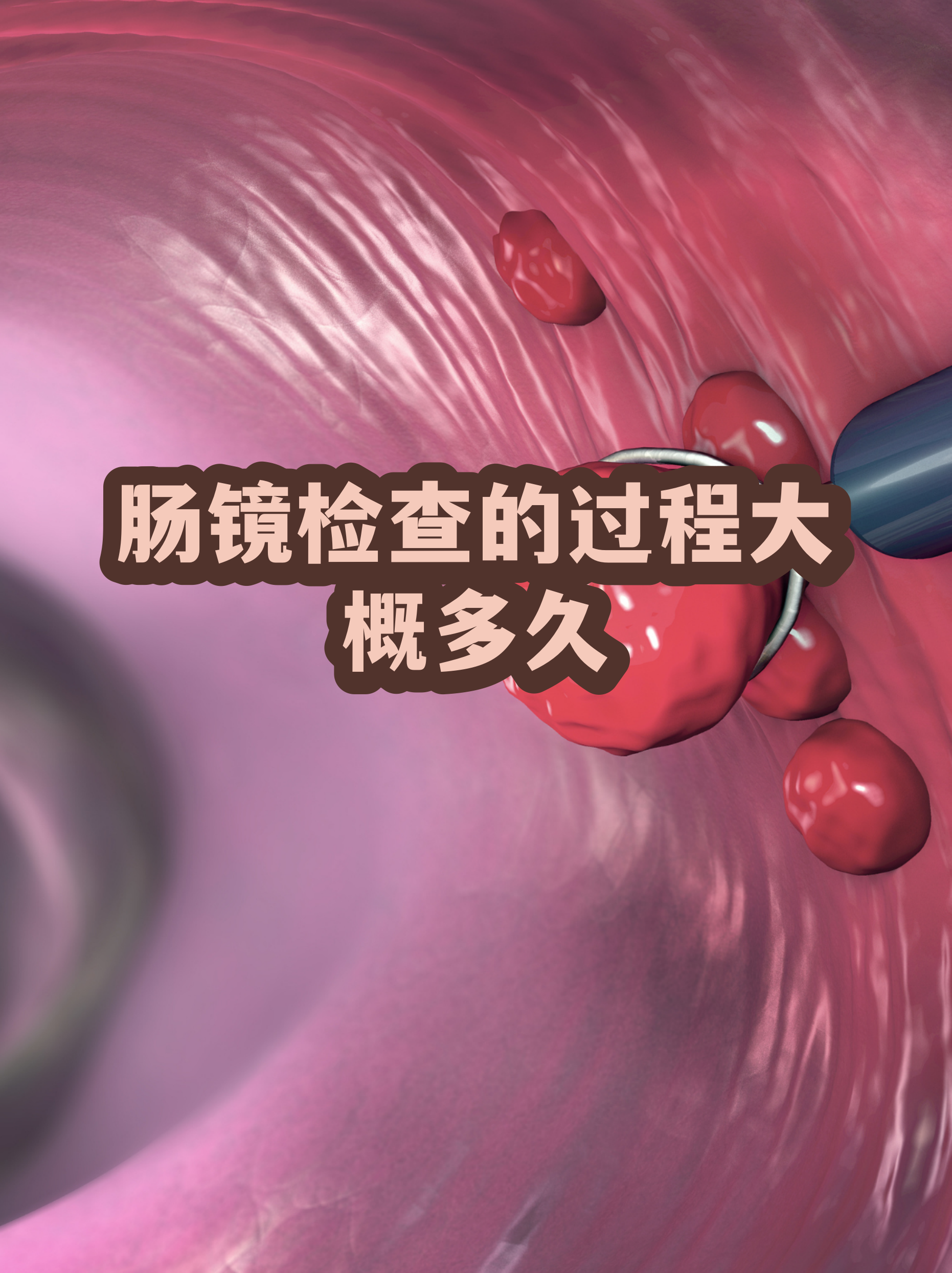 肠镜清肠标准黄水图片(少量粪渣和黄水可以做肠镜吗) 肠镜清肠标准黄水图片(少量粪渣和黄水可以做肠镜吗)