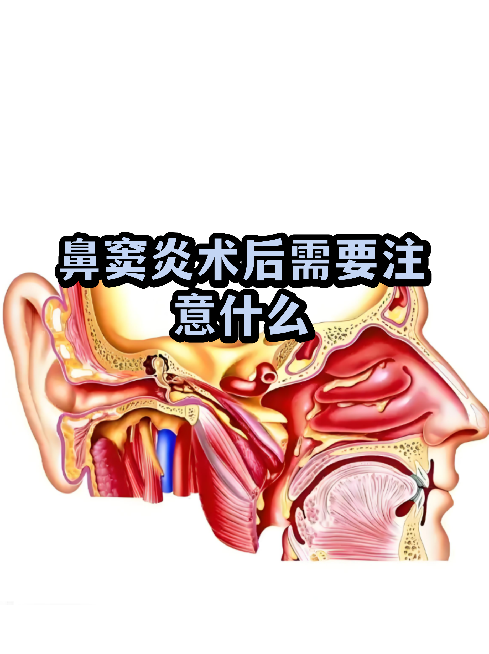 鼻窦炎抽出的脓图片(鼻窦炎怎样治疗才能根除)