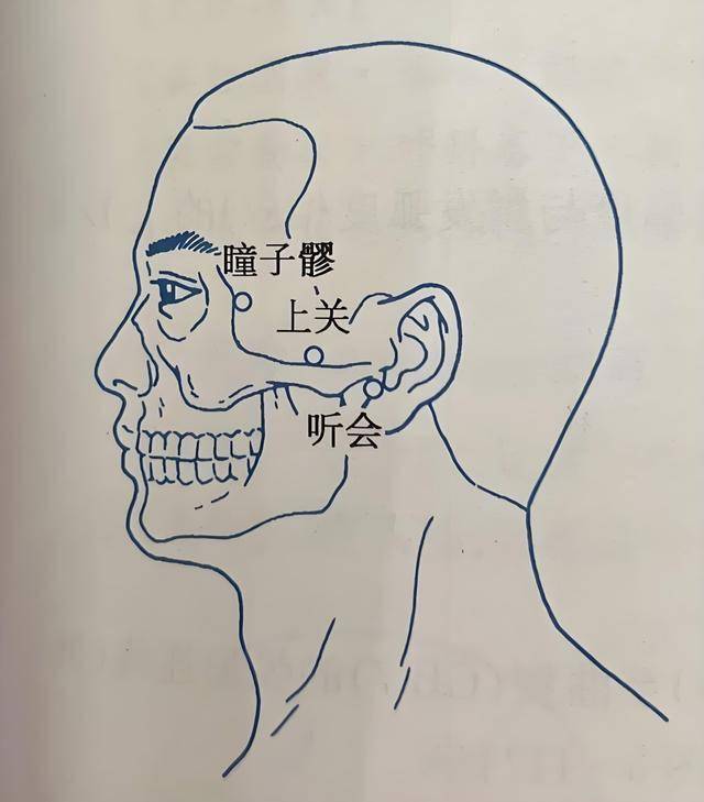 上关穴(上关穴定位) 上关穴(上关穴定位)
