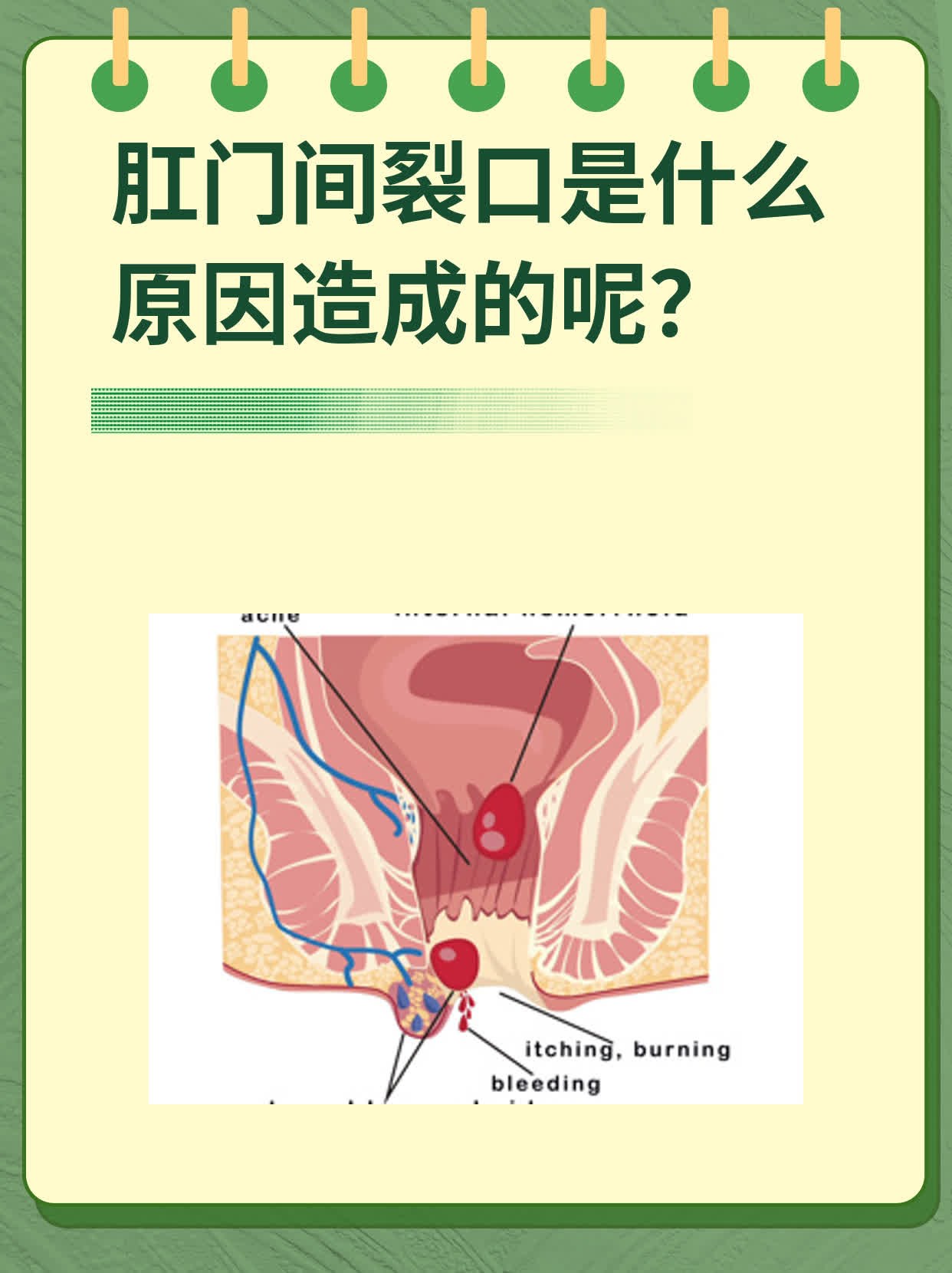 什么是肛裂的症状图片(什么是肛裂 怎么造成的) 什么是肛裂的症状图片(什么是肛裂 怎么造成的)
