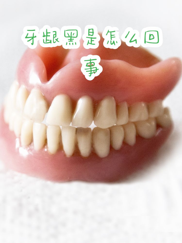 牙龈发黑的图片及如何改善(牙龈发黑要怎么治疗才可以恢复)
