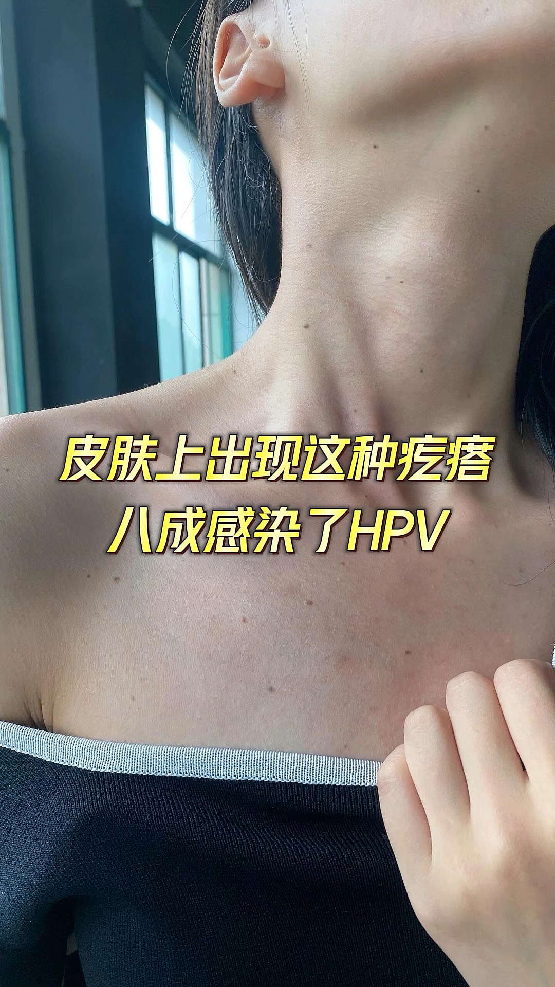 女士感染hpv图片(女性感染hpv早期症状图片)