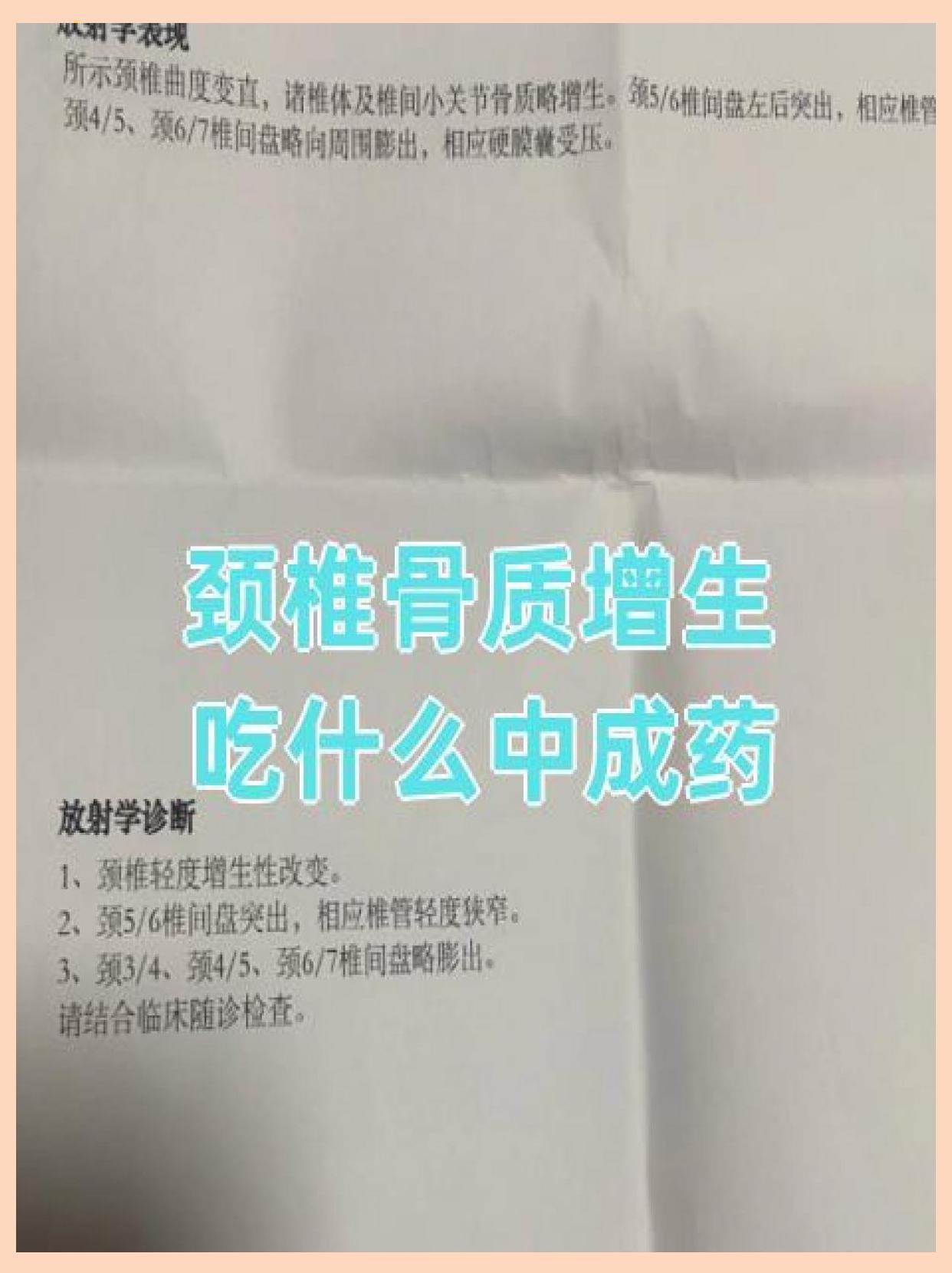 骨刺宁胶囊(骨刺宁胶囊的害处)