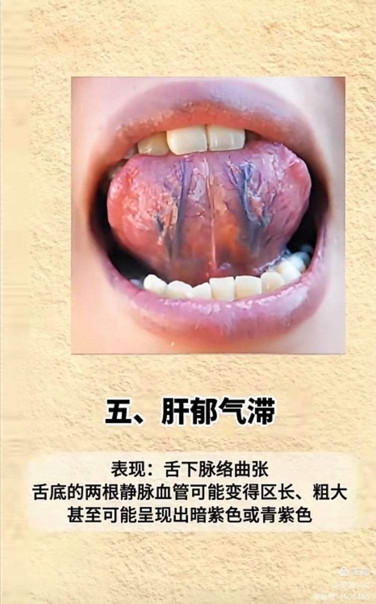 正常舌头下面图片(正常的舌头根部图片) 正常舌头下面图片(正常的舌头根部图片)