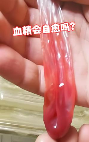 血精图片(血精图片 怎么回事)