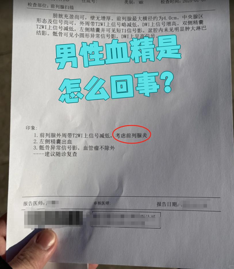 血精图片(血精图片 怎么回事) 血精图片(血精图片 怎么回事)