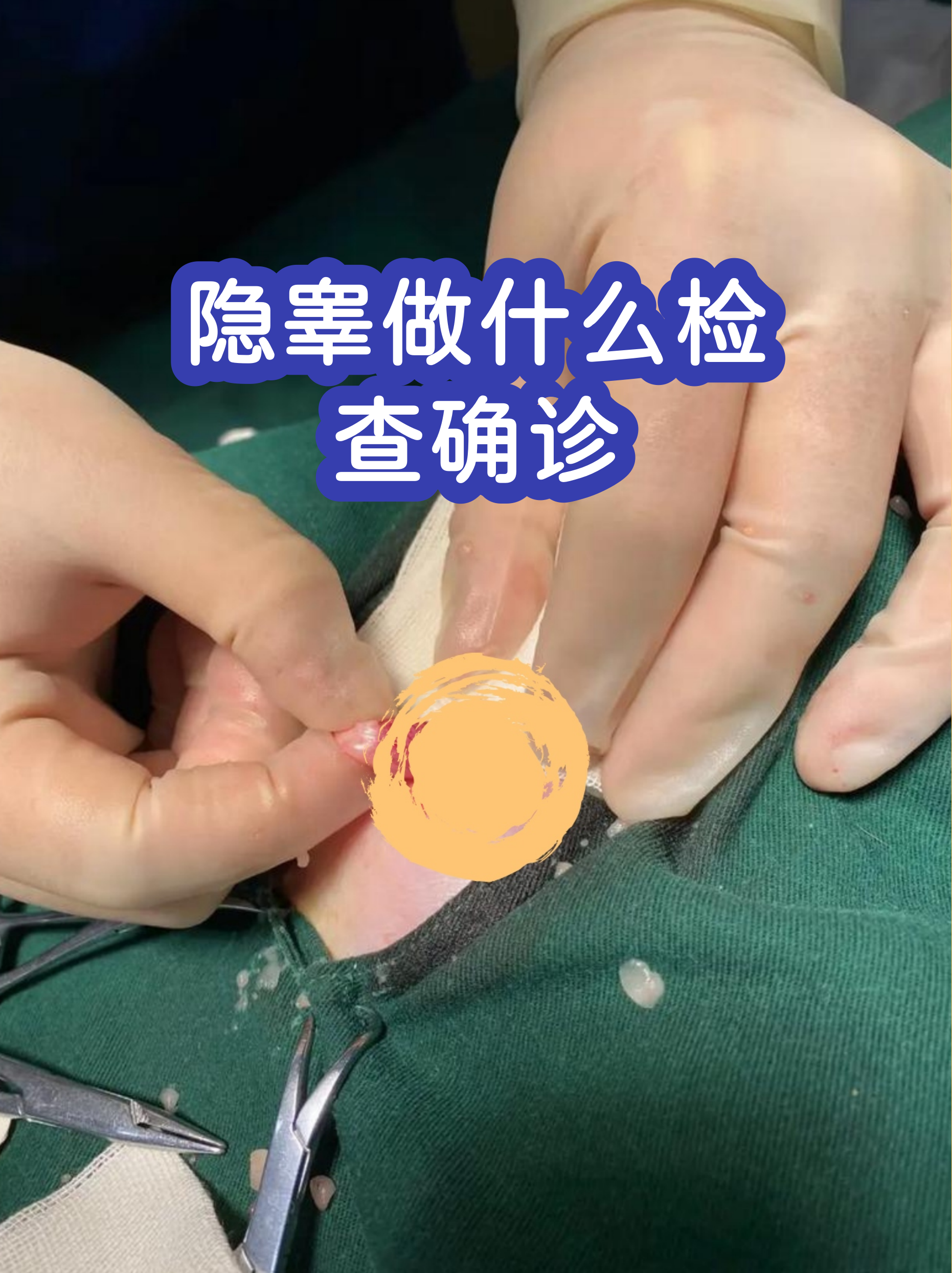 正常的阴囊应该是怎样的图片(正常的阴囊应该是怎样的图片呢) 正常的阴囊应该是怎样的图片(正常的阴囊应该是怎样的图片呢)