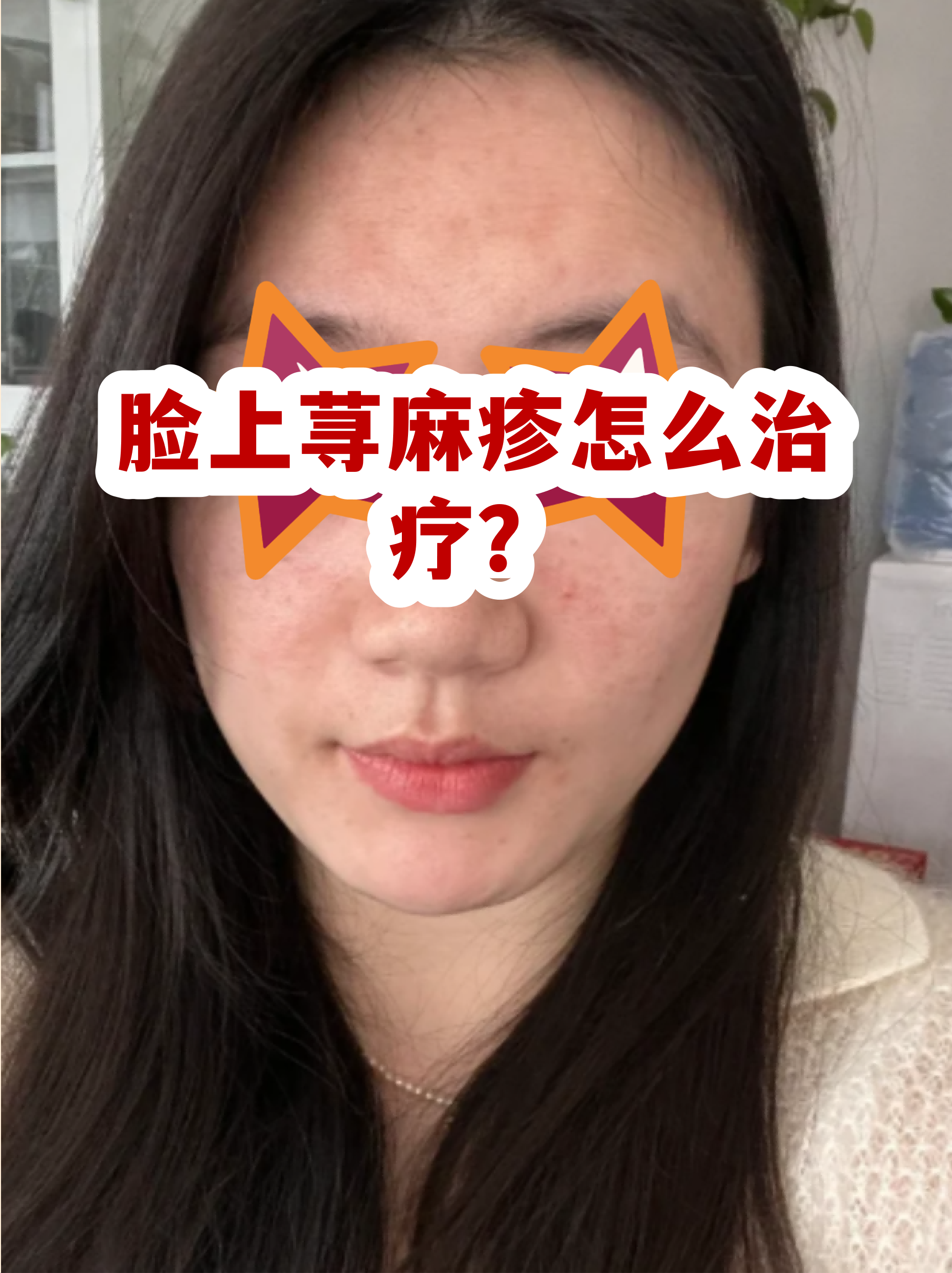 过敏皮炎症状图片大全(过敏皮炎图片和症状图片) 过敏皮炎症状图片大全(过敏皮炎图片和症状图片)
