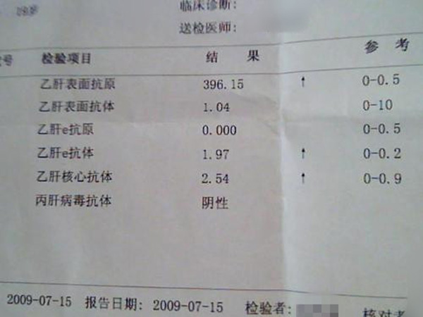 乙肝化验单正常的图片(乙肝化验单正常的图片高清) 乙肝化验单正常的图片(乙肝化验单正常的图片高清)