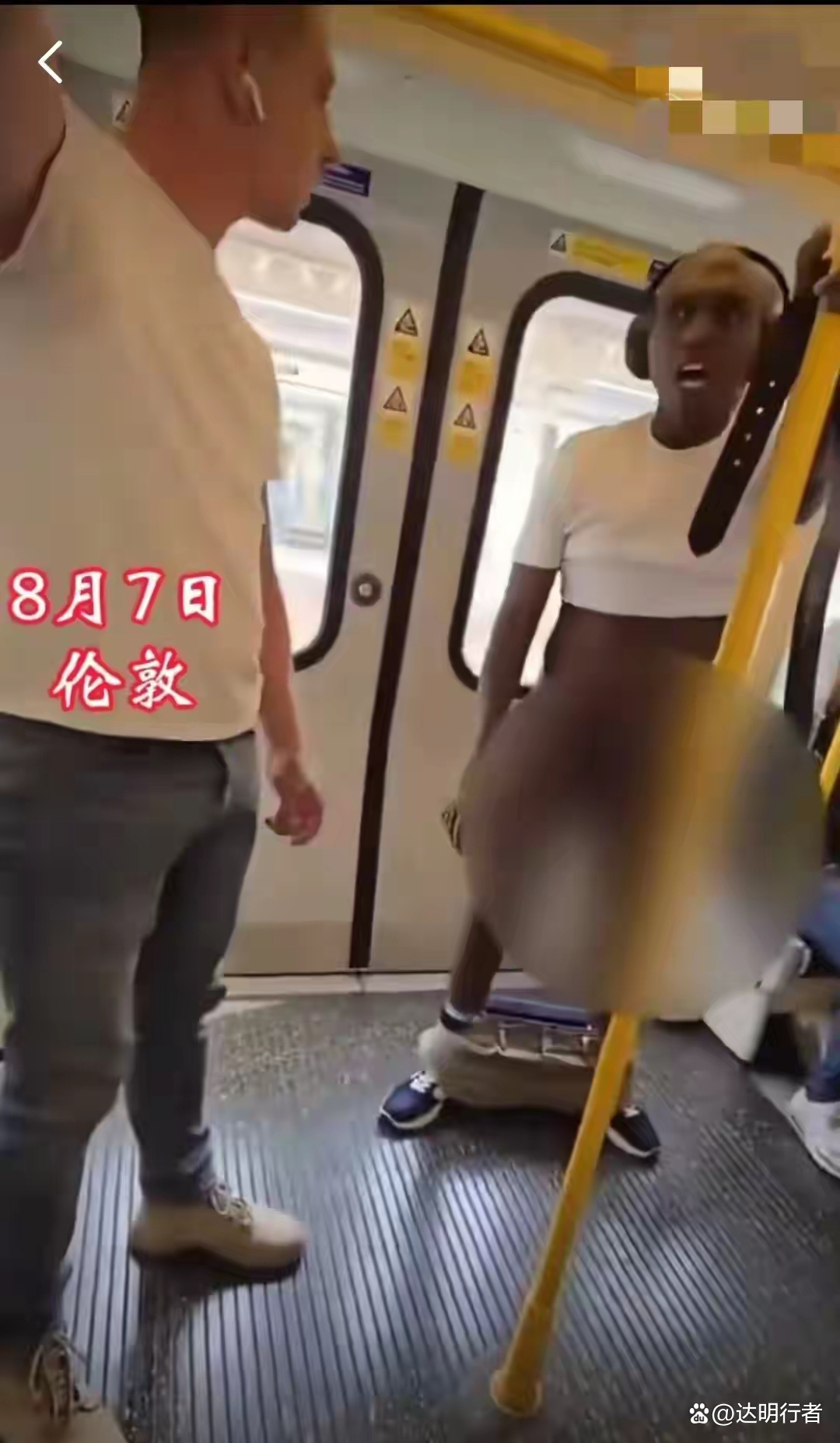 下体图片(丝状疣女性下体图片) 下体图片(丝状疣女性下体图片)
