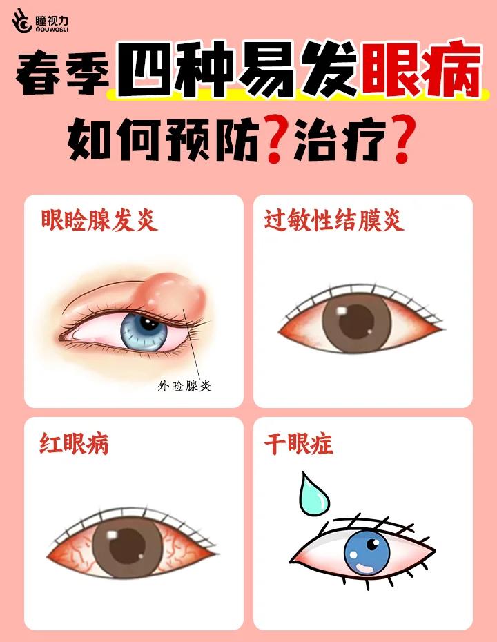 18种常见眼科疾病(18种常见眼科疾病图片 新闻)
