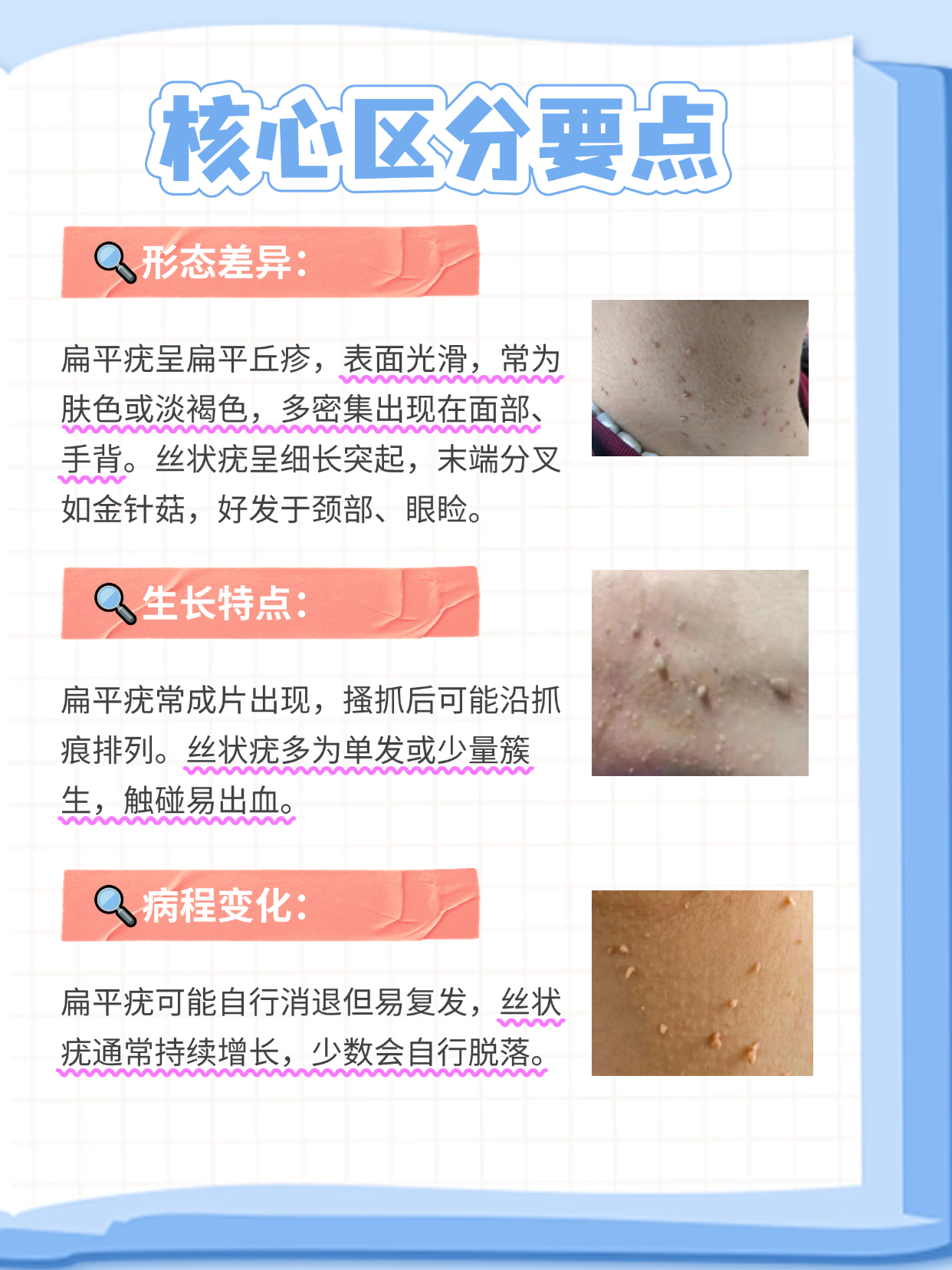 疣和瘊子的区别图片(疣和瘊子的区别图片黑色)
