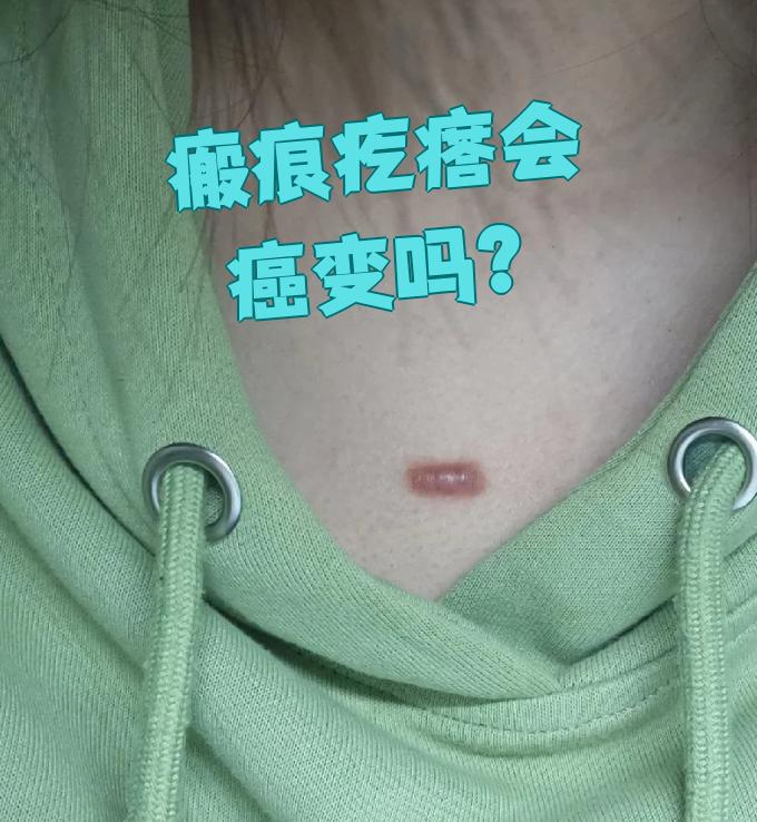 疤痕增生一开始图片(伤口一般多久开始增生)