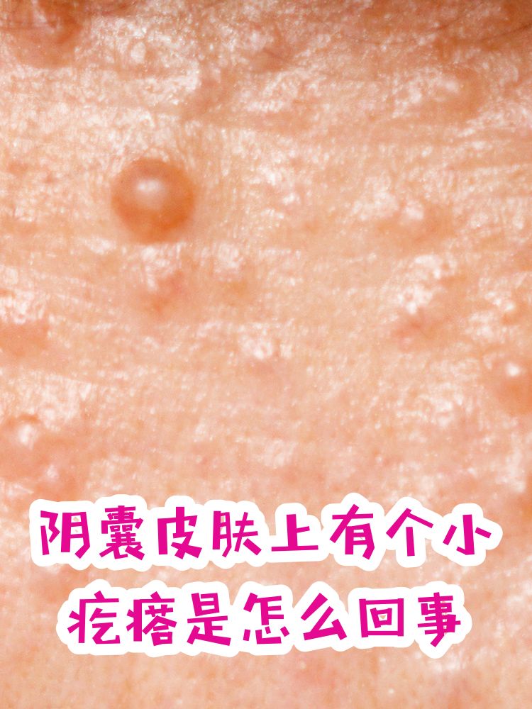 正常的阴囊是什么状态图片(正常的阴囊是什么状态图片女) 正常的阴囊是什么状态图片(正常的阴囊是什么状态图片女)
