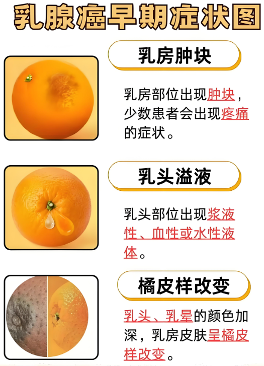 乳腺癌早期肿块图片图(乳腺癌早期症状的肿块按着会疼吗)