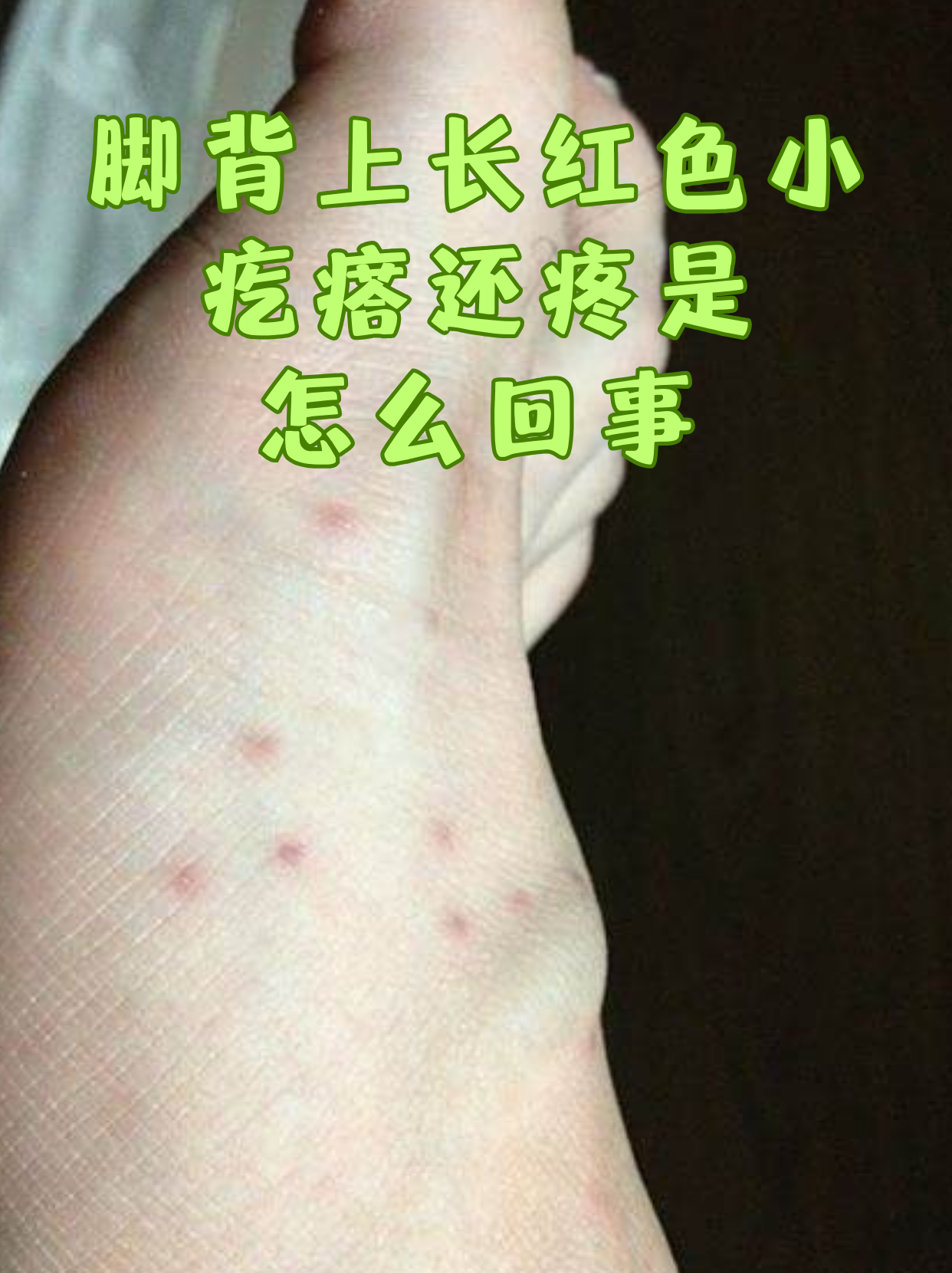脚面鼓起来个疙瘩图片(脚面鼓起来个疙瘩图片女)
