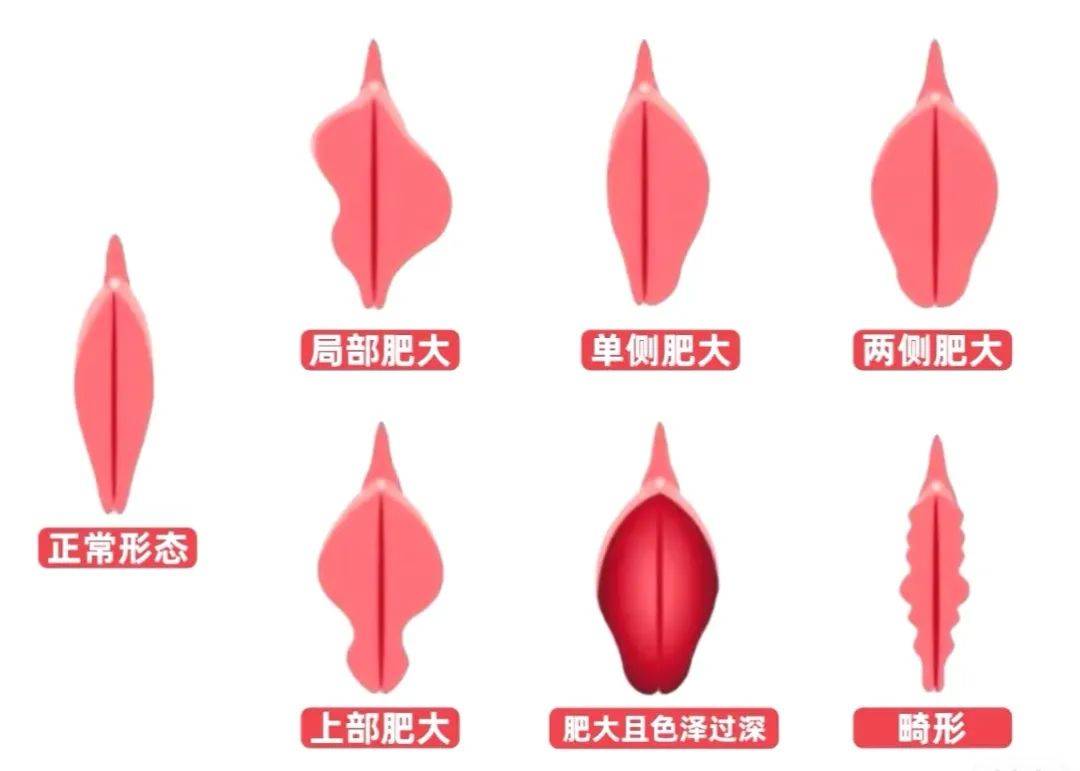 女孩阴道图片的简单介绍 女孩阴道图片的简单介绍