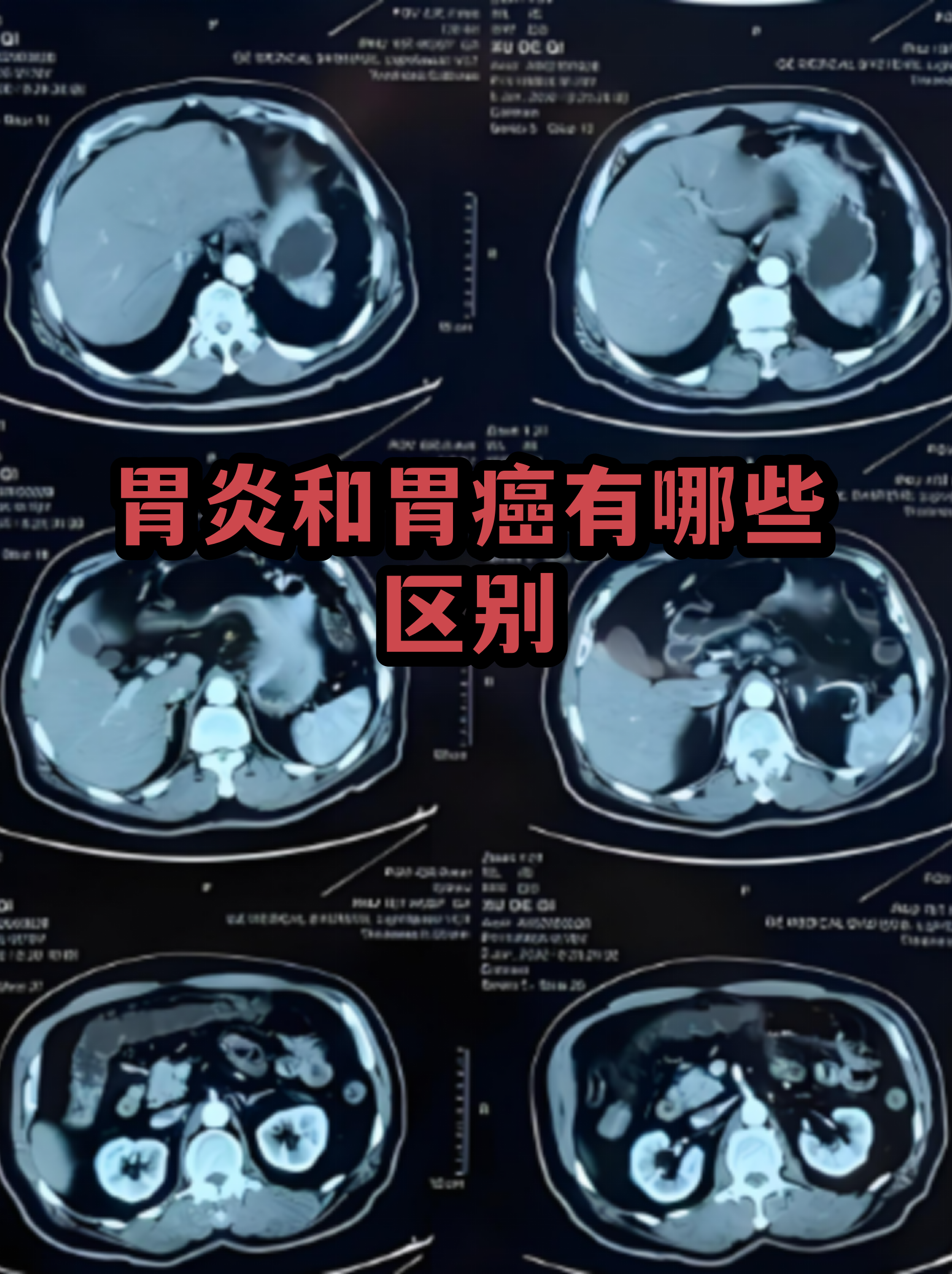 人有几个胃(人有几个胃在什么位置) 人有几个胃(人有几个胃在什么位置)