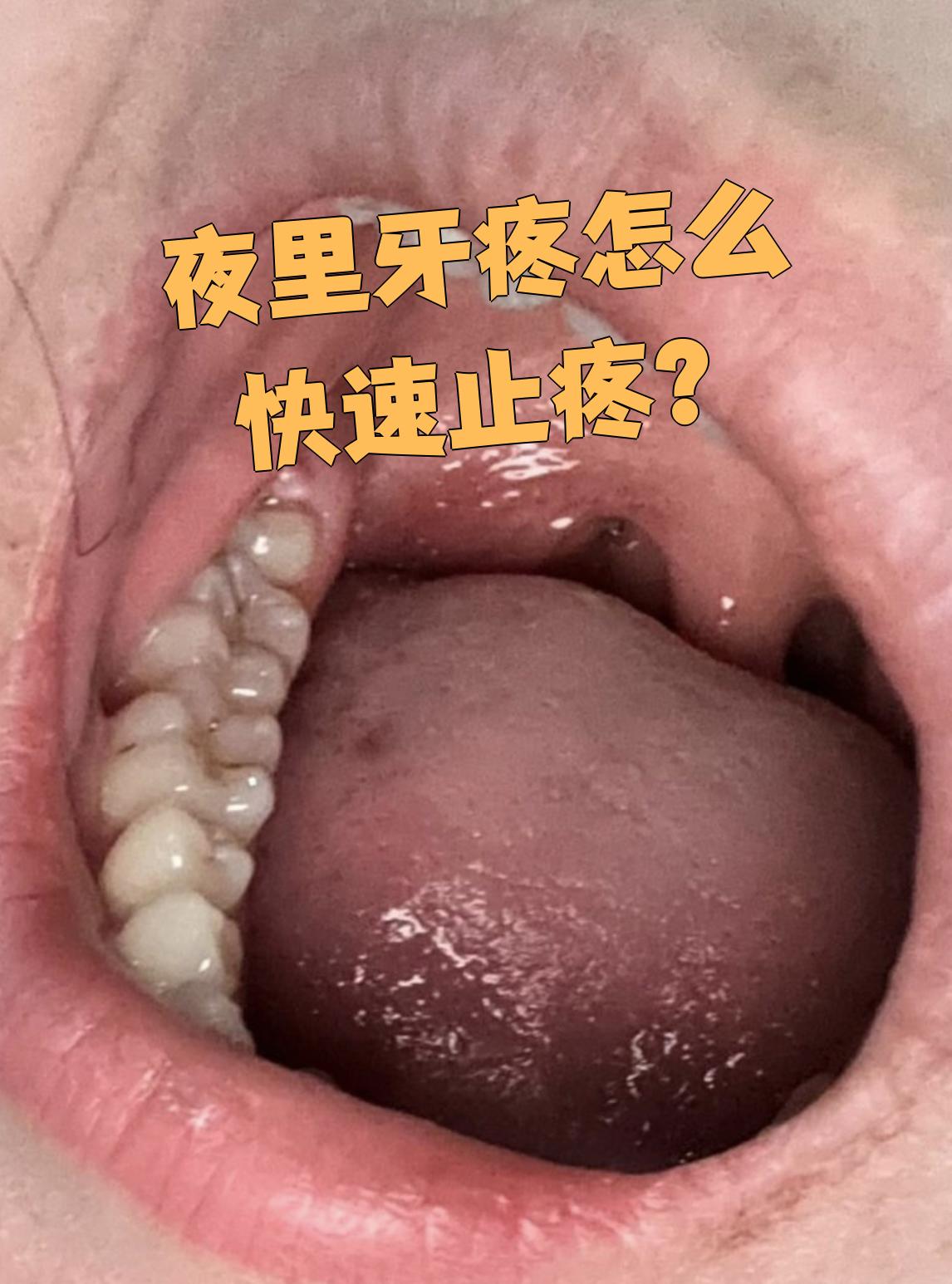 牙疼图片可怜图片(牙疼图片可怜图片可爱)