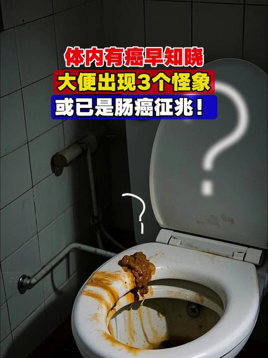 大肠癌早期大便图片(大肠癌的早期症状便便图) 大肠癌早期大便图片(大肠癌的早期症状便便图)