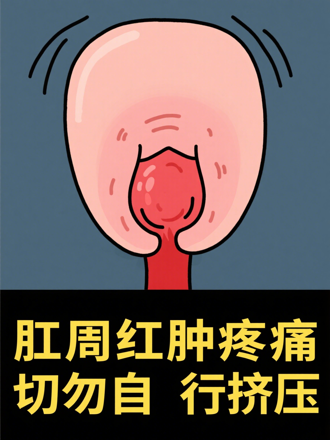 肛门图(健康肛门和痔疮肛门图片) 肛门图(健康肛门和痔疮肛门图片)