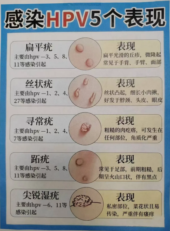 疣体初期图片(疣体一般长什么样子)