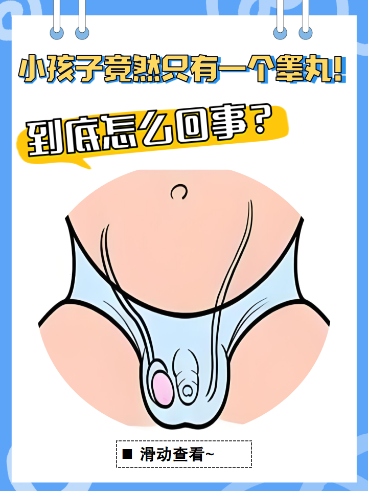 隐睾症的外观真实图片(隐睾症最可能发生的疾病)