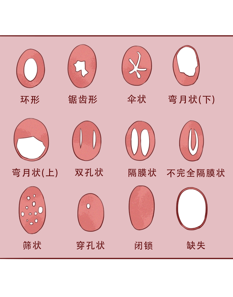 关于女性私处图片的信息