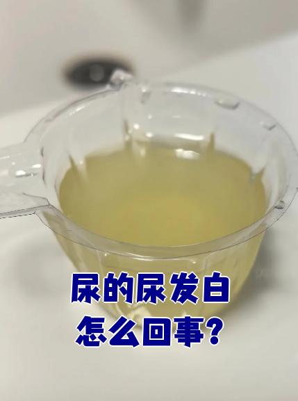 小便尿出白色东西图片(撒尿先尿出一段白色尿是怎么回事)