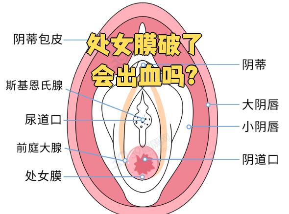 处女膜实物(处女 膜是什么) 处女膜实物(处女 膜是什么)