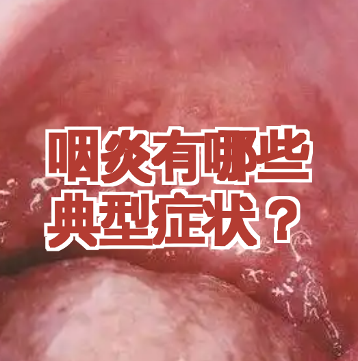 咽炎图片和正常图片对比(咽炎的症状图片,咽炎图片大全)
