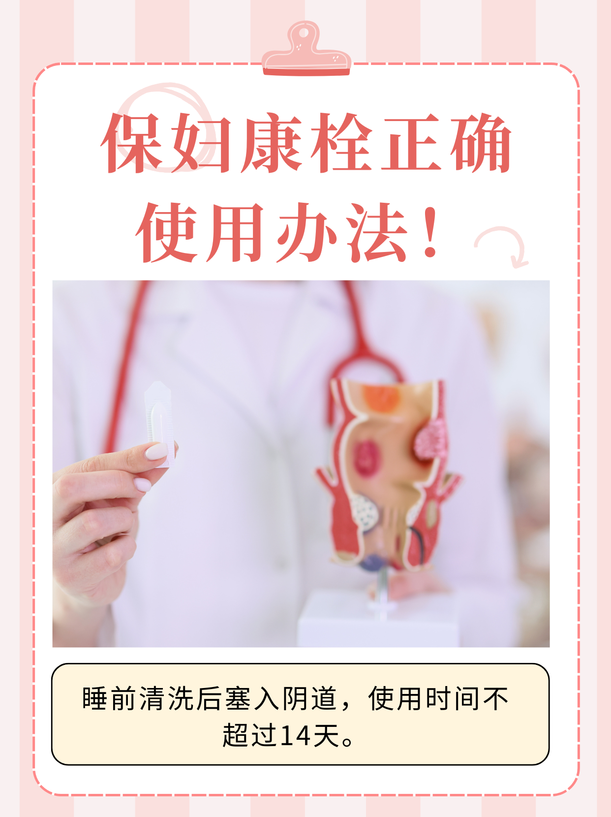 康妇特栓(康妇特栓剂的作用)