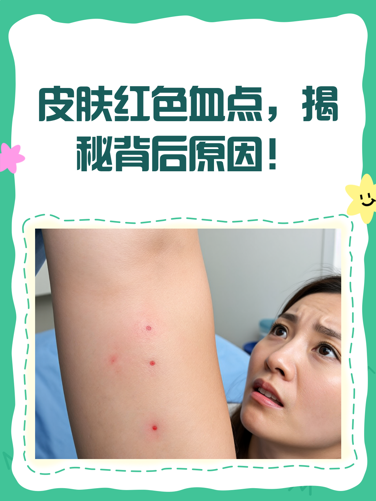 血点图片(白血病出血点图片) 血点图片(白血病出血点图片)