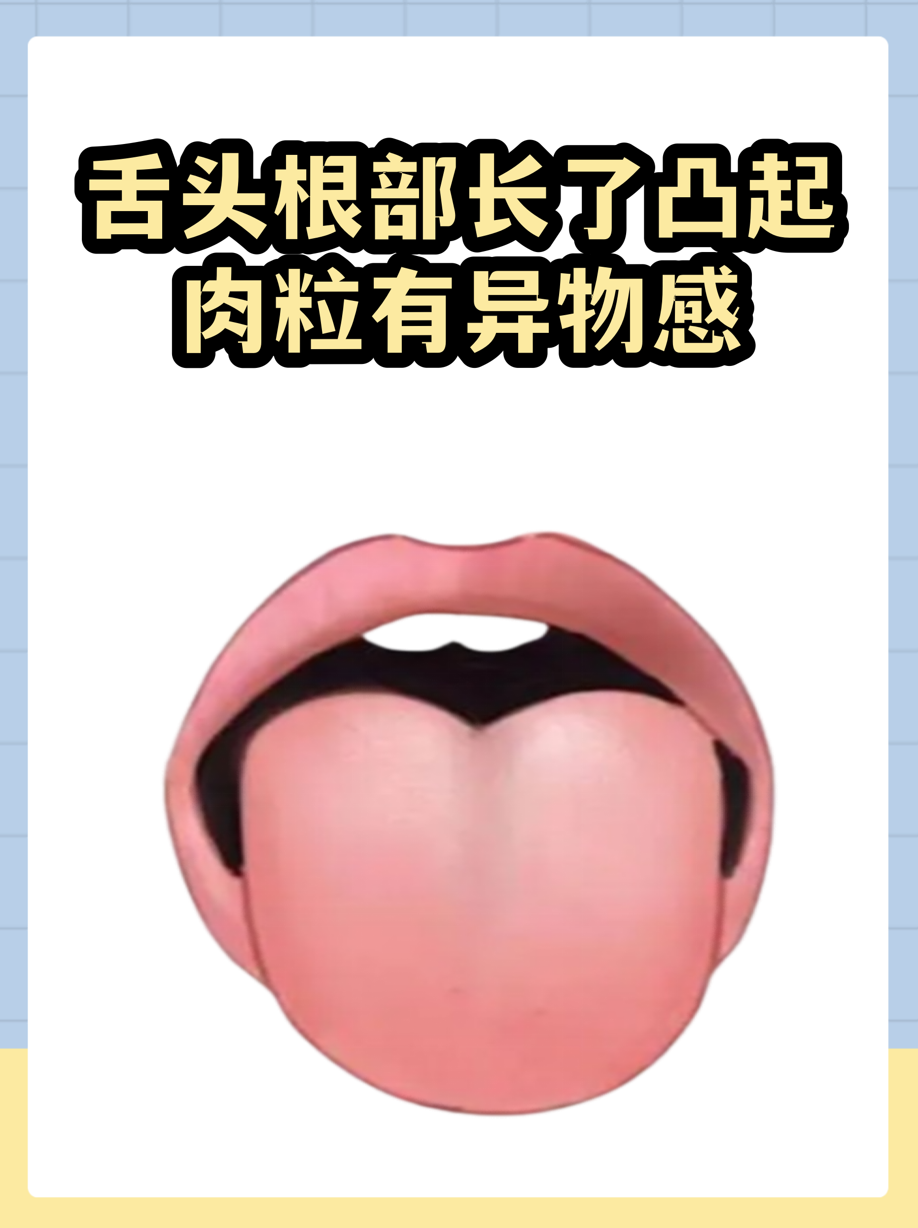 正常人的舌头图片(正常人的舌头图片长短) 正常人的舌头图片(正常人的舌头图片长短)