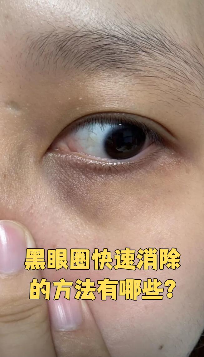 熬夜图片黑眼圈(熬夜图片黑眼圈大全) 熬夜图片黑眼圈(熬夜图片黑眼圈大全)