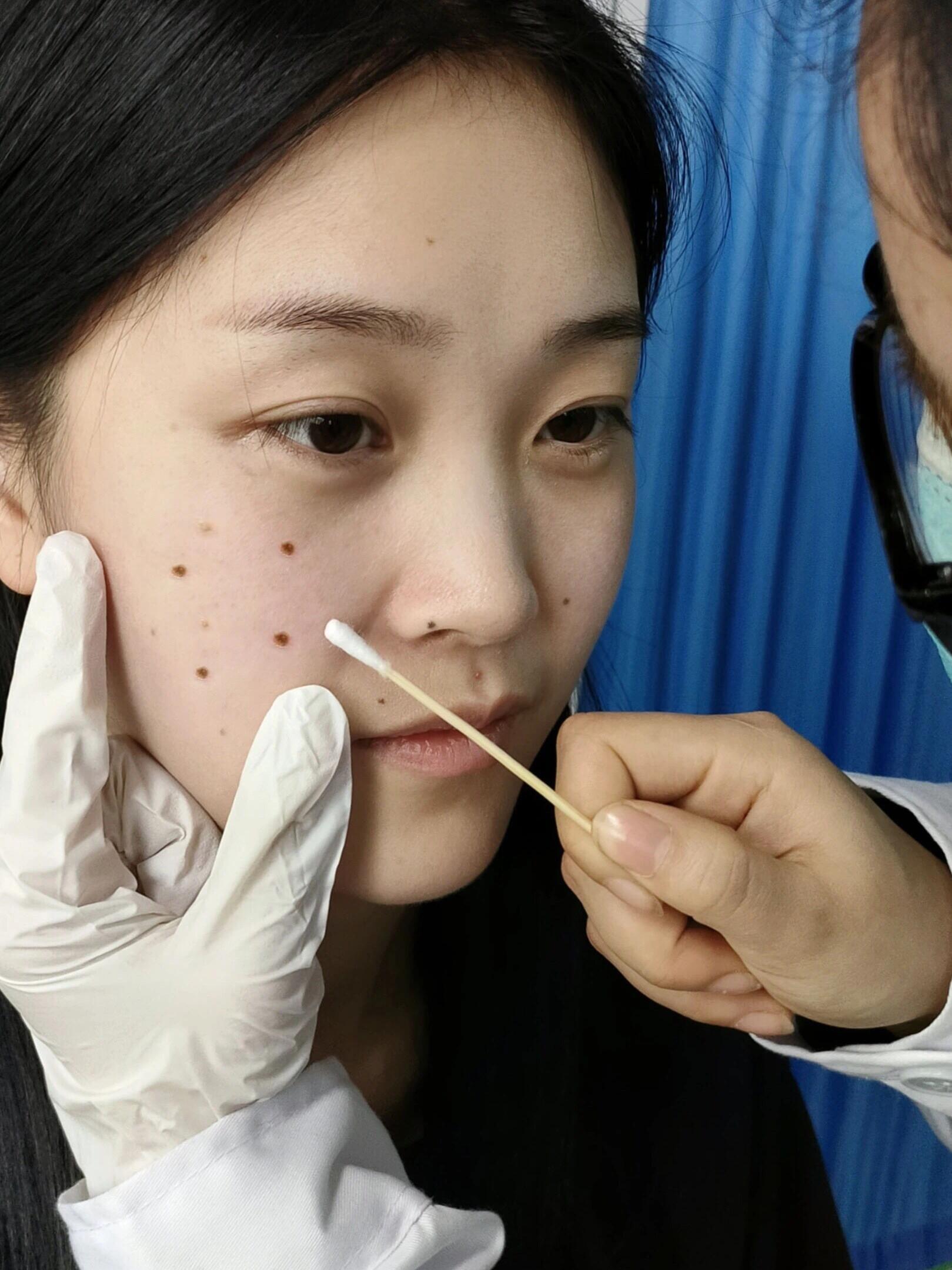 点痣图片女标准(点痣图解女高清图片 面相) 点痣图片女标准(点痣图解女高清图片 面相)