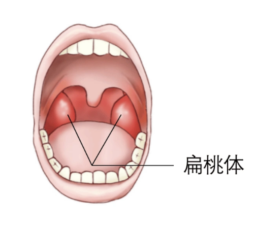 儿童正常扁桃体高清图(儿童正常扁桃体高清图 肥大)