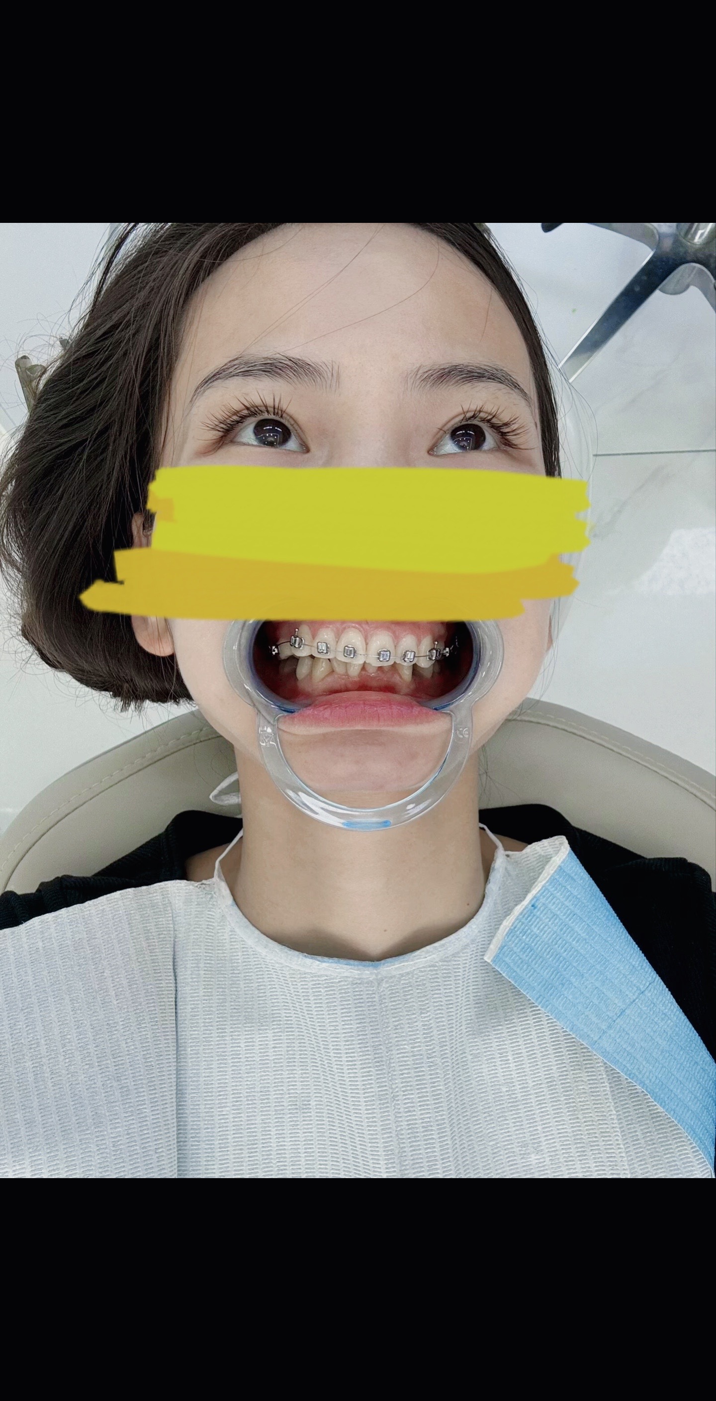 梦见掉了三颗牙齿是什么意思(梦见掉了三颗牙齿是什么意思 女人) 梦见掉了三颗牙齿是什么意思(梦见掉了三颗牙齿是什么意思 女人)