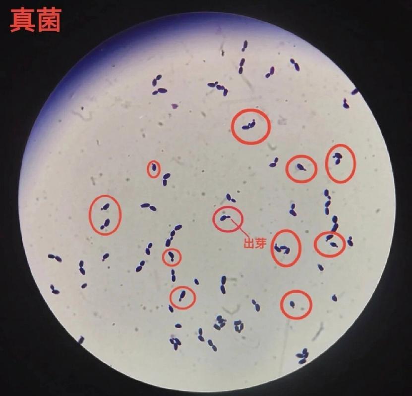 细菌和真菌图片大全(细菌与真菌的区别八年级生物图示) 细菌和真菌图片大全(细菌与真菌的区别八年级生物图示)