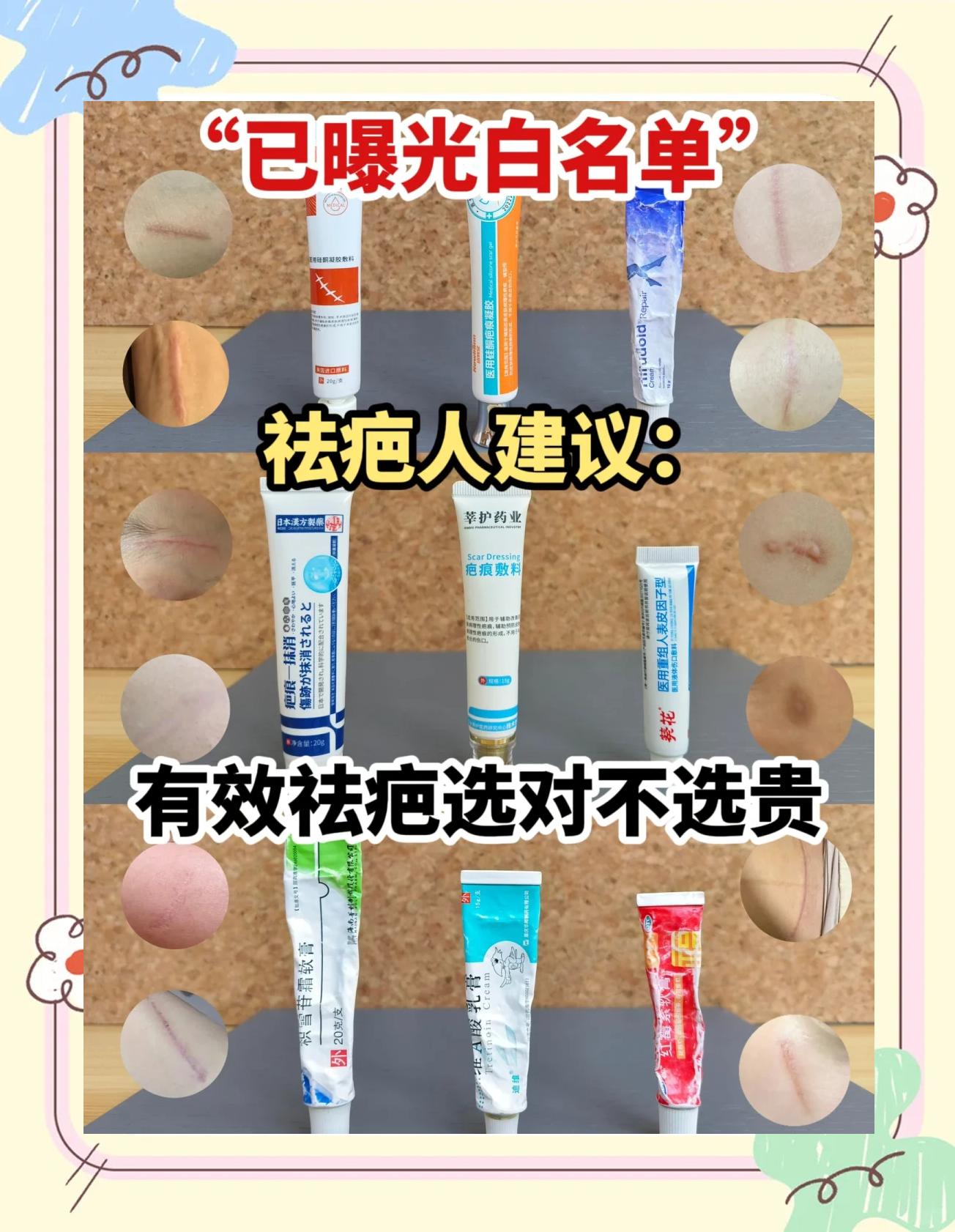 除疤膏哪种好(除疤膏最好的排名) 除疤膏哪种好(除疤膏最好的排名)