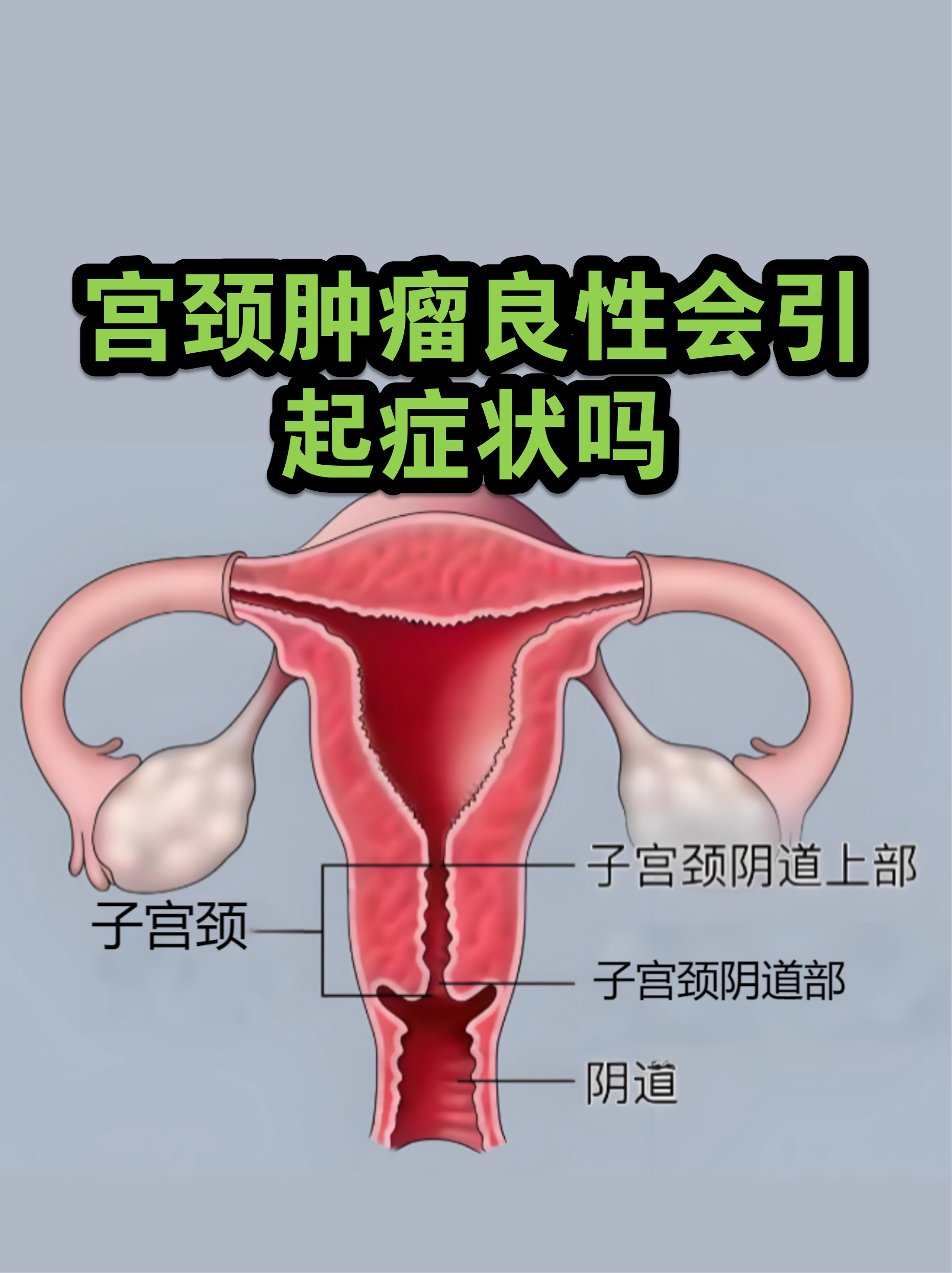 宫颈图(子宫宫颈图) 宫颈图(子宫宫颈图)