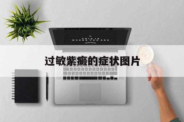 过敏紫癜的症状图片(过敏性紫癜的症状图片) 过敏紫癜的症状图片(过敏性紫癜的症状图片)